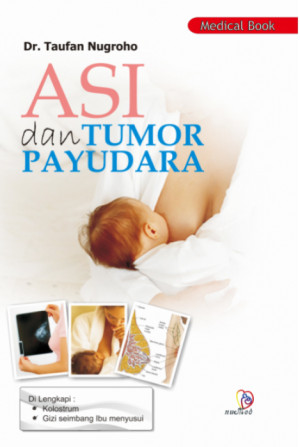 Image of Asi dan Tumor Payudara