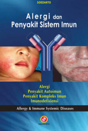 Image of Alergi dan Penyakit Sistem Imun, Alergi, penyakit autoimun, penyakit kompleks imun, imunodefisiensi=allergy and immune systemic diseases