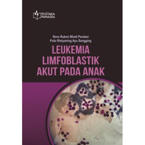 Image of Leukemia Limfoblastik Akut Pada Anak