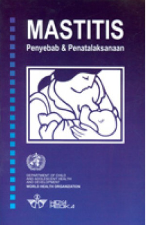 Image of Mastitis : Penyebab Dan Penatalaksanaan