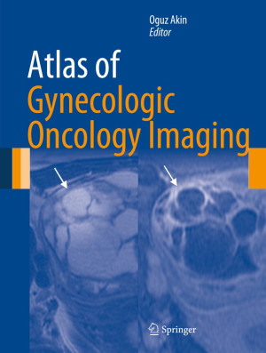 Image of An atlas of gynecologic oncology : investigation and surgery